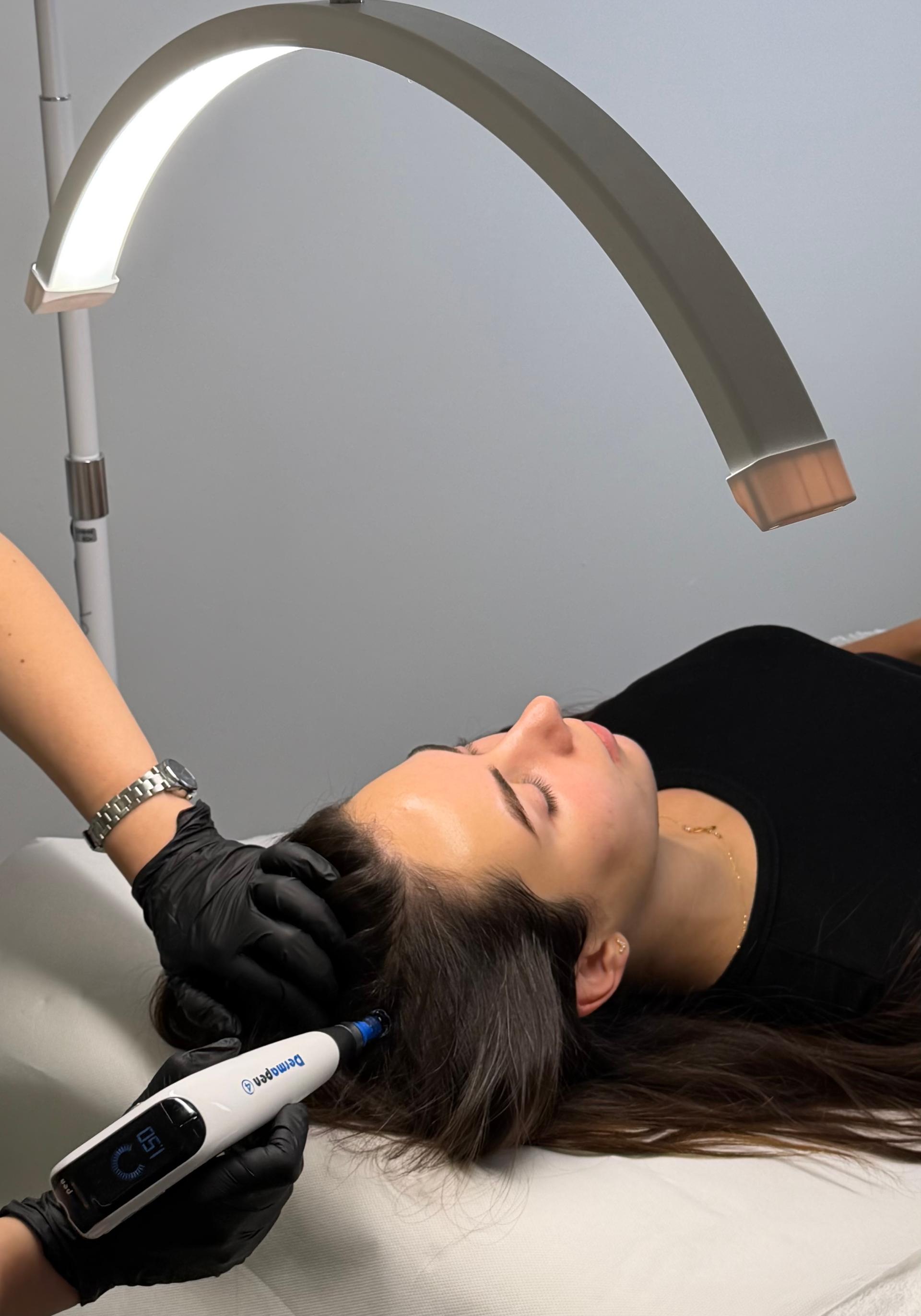 Microneedling Haar met Dermapen 4™ (voor Hoofdhuid)