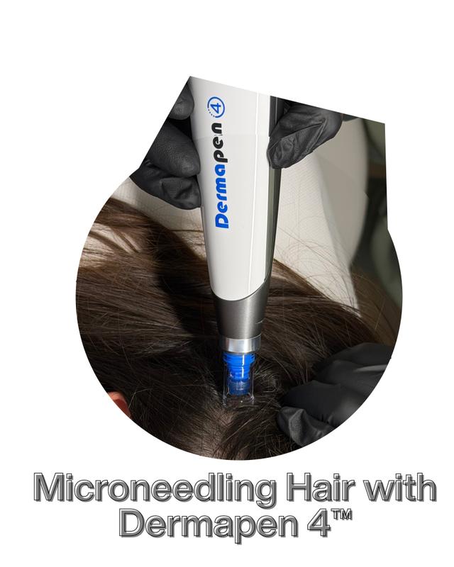 Microneedling Hair with Dermapen 4™ (for Scalp)