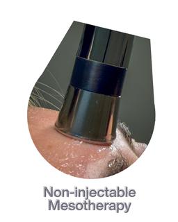 Non-injectable Mesotherapy